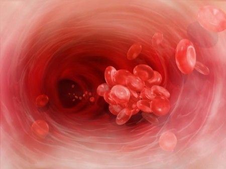 UPN_Septicemia_salud