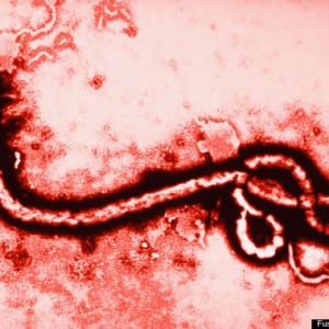 el virus del ébola