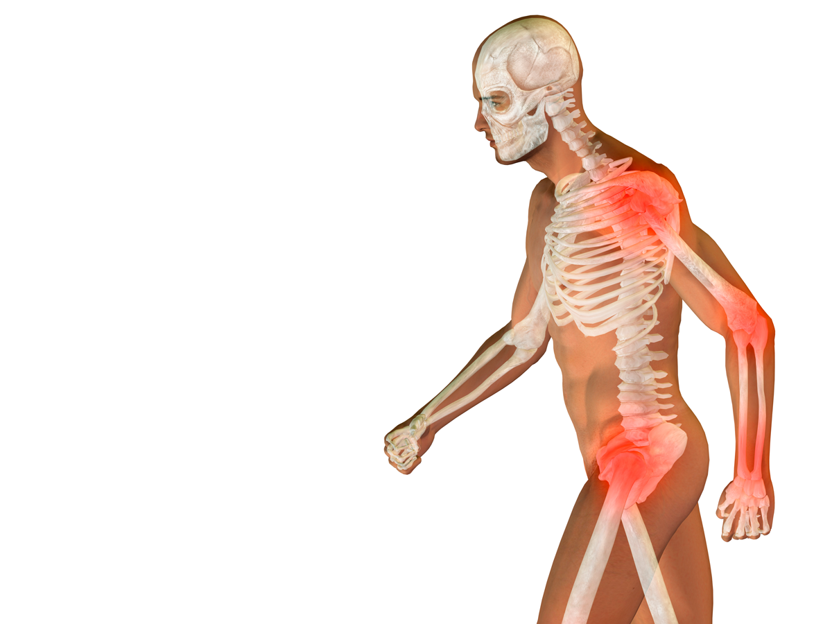 upn_salud_osteoporosis