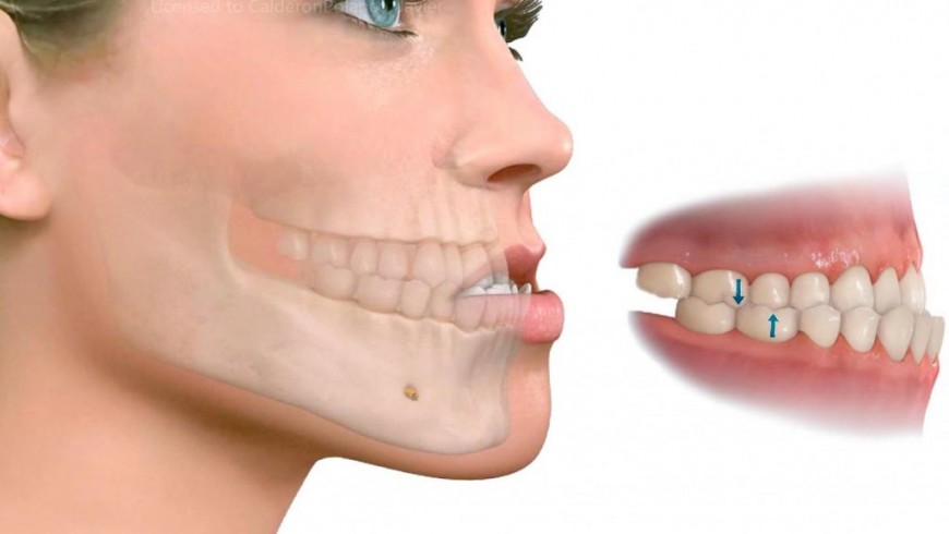 oclusión dental salud